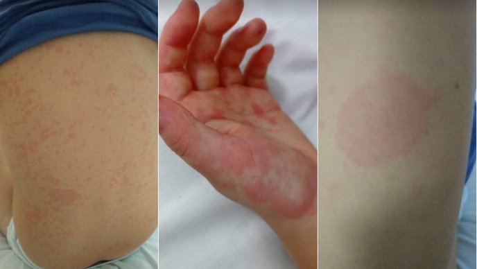 postcovid25122020wweb jpg 688x388 q85 crop upscale