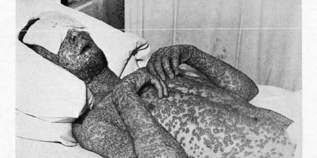 variola vera jugoslavija etnoistorija crnegore fb1