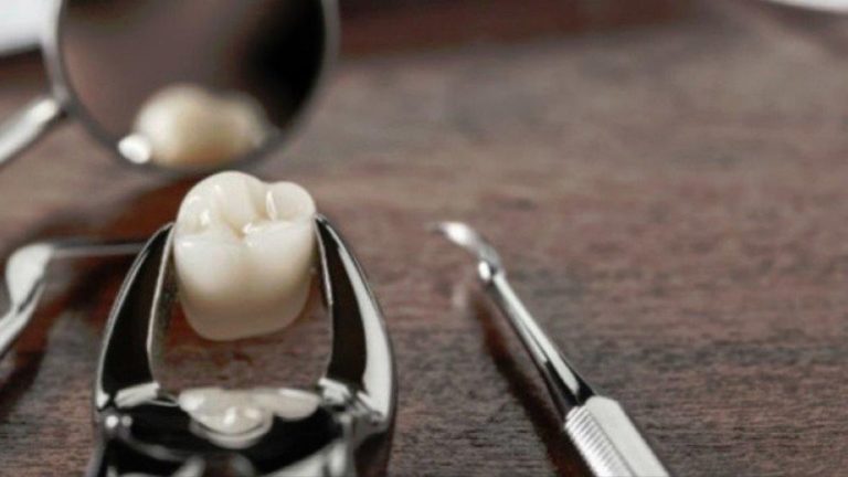 Mislite na vrijeme: Koja je stvarna cijena vađenja zuba